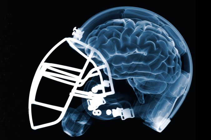 football-brain-ocotber-2009